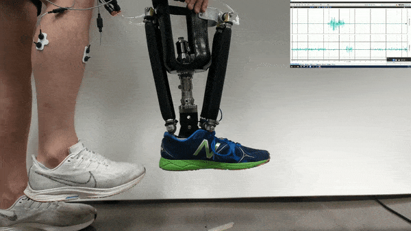 Brain Signals Can Drive Exoskeleton Parts Better With Therapy
